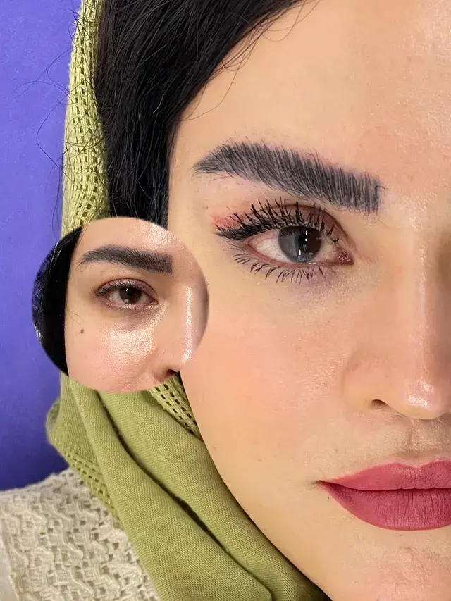 کلینیک زیبایی ماه تا