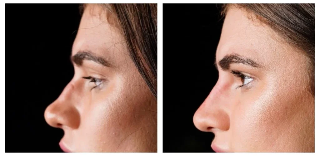 بینی ترند ۲۰۲۵