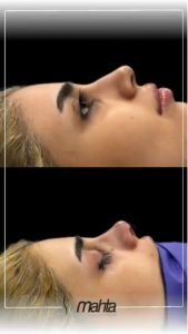 کلینیک زیبایی ماه تا