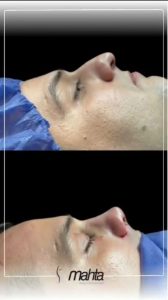 کلینیک زیبایی ماه تا