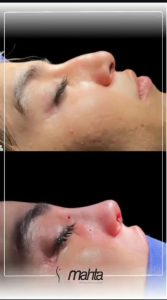 کلینیک زیبایی ماه تا