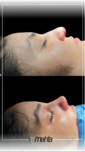 کلینیک زیبایی ماه تا