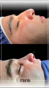 کلینیک زیبایی ماه تا