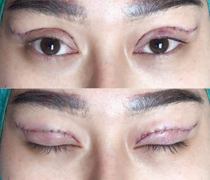 کلینیک زیبایی ماه تا